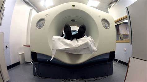 ct scan